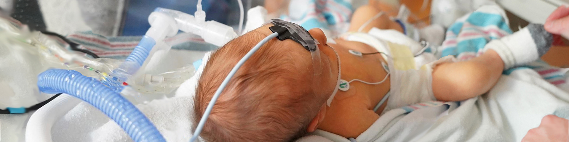 Baby in the Cardiac Care Bay