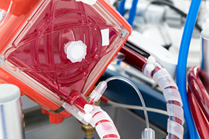 ECMO machine