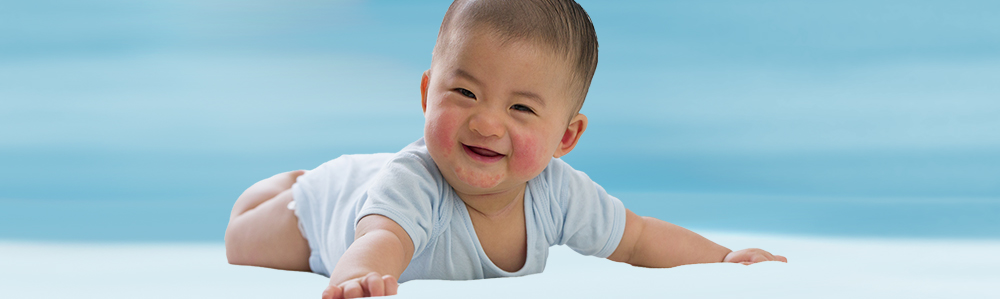 Baby with rash on face