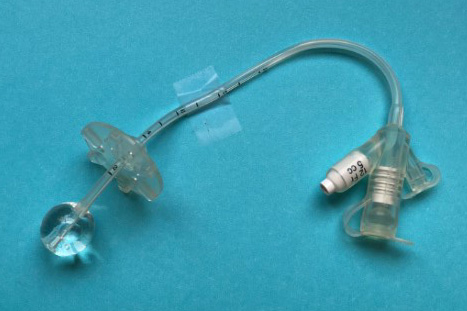 Long-Mic G-tube