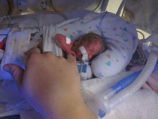 Nichole Laplaca in the NICU