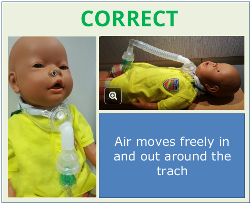 Correct nebulizer arrangement