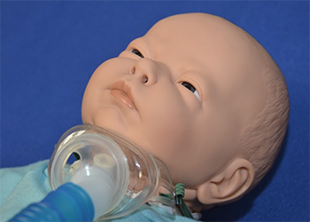 Mist collar is placed over tracheostomy tube