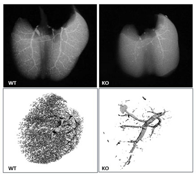 lung photo