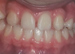 closeup of teeth