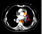 Radiologic Image