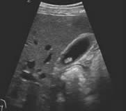 Ultrasound Fellowship