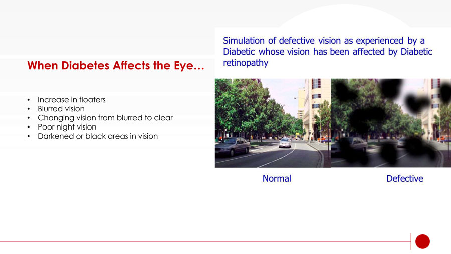 healthy eyes slide 14