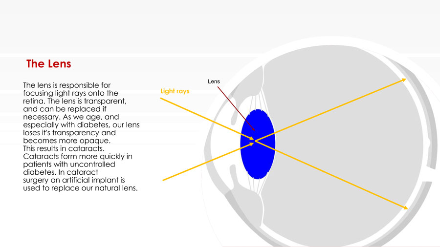 healthy eyes slide 5