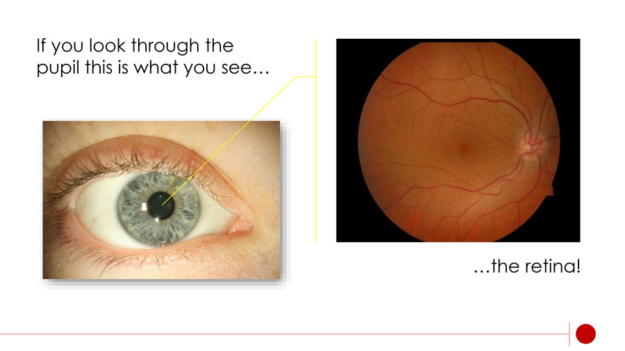 healthy eyes slide 6