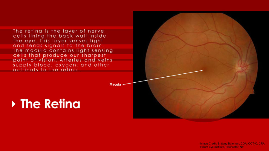 healthy eyes slide 7