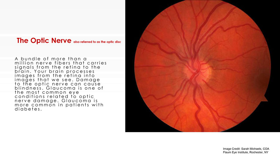 healthy eyes slide 8