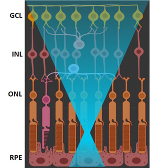 Diagram of the laser lesions