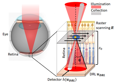 Illustration of the 3D process