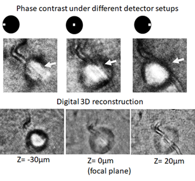 Photos of the phase contrasts