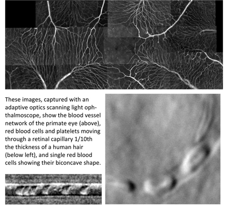 Blood Flow image