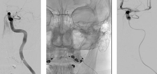 Highland Stroke Center Slide 2