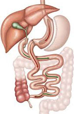 Gastric Bypass