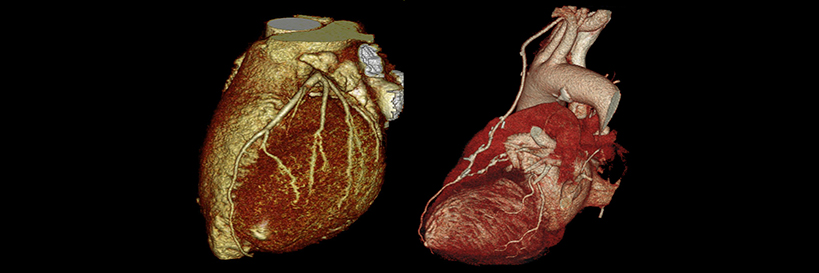 heart image