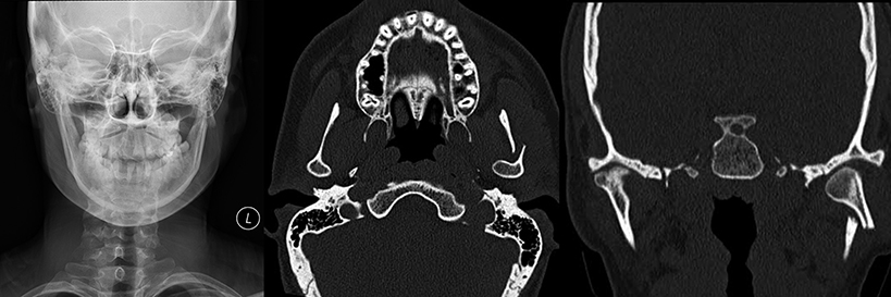 Neuroradiology image