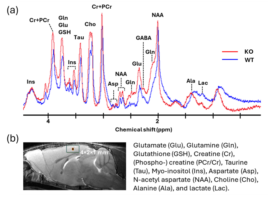 Figure of Magnetic Resonance Spectroscopy