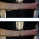 Non-Invasive Measures of Bone Health and Quality