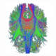 Effects of Concussion and Repetitive Head Hits on Brain Structure and Function