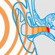 Otoacoustic Emissions and Auditory Feedback in Minimally Verbal Children with ASD