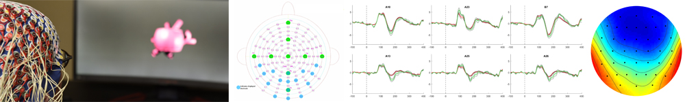 Electroencephalography – EEG