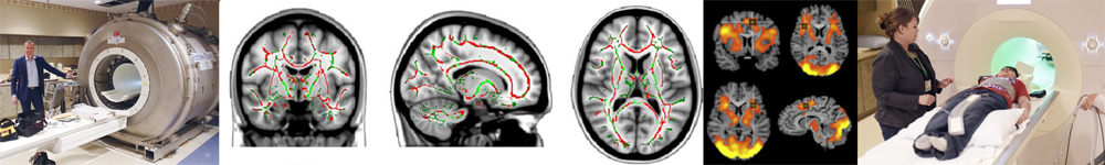 Magnetic Resonance Imaging – MRI