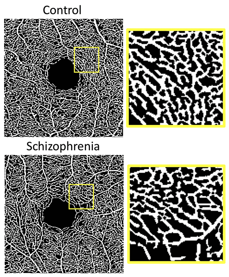 retina scan highlighting an area