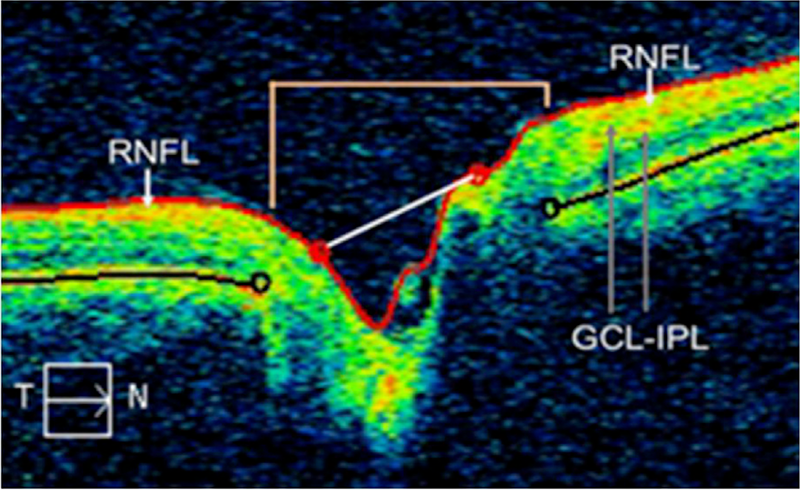 close up of eye scan