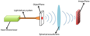 acoustic lens