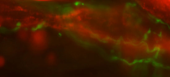 Image of Sympathetic nerves