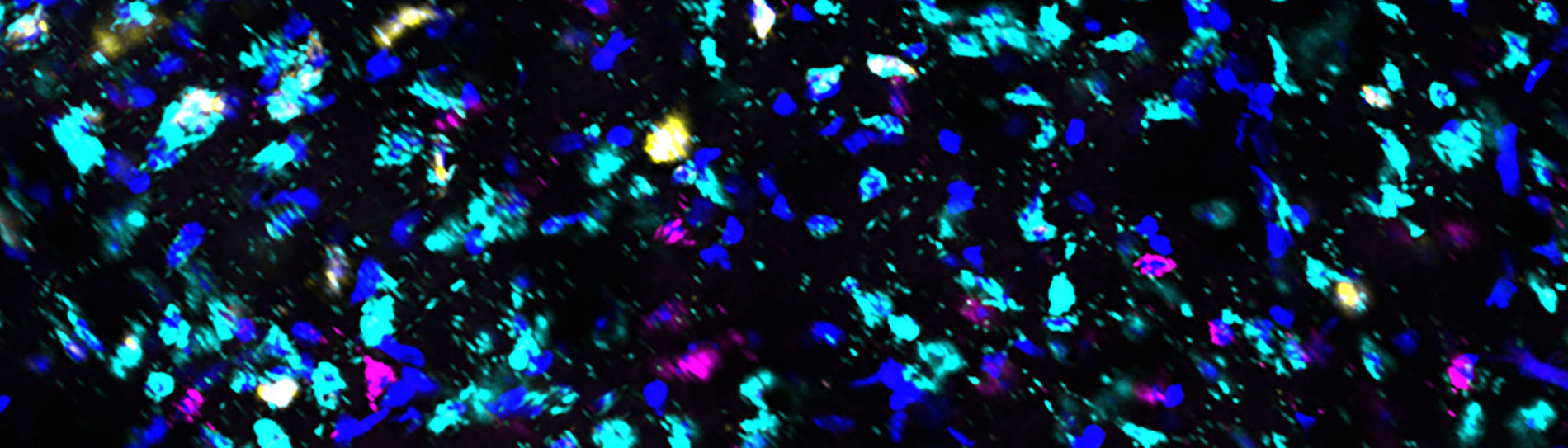 RNA Scope in situ hybridization of the mouse brain