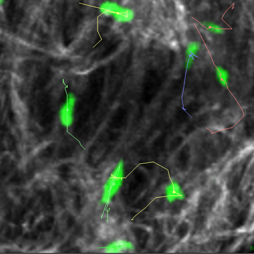 Effector helper T cells migrating through collagen (grey) in the inflamed ear dermis