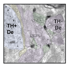 Electron microscopic image