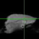 resting state functional MRI image