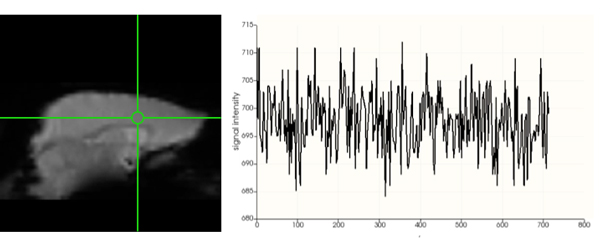 Image of resting state functional MRI