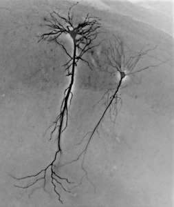 Example image of a neurons