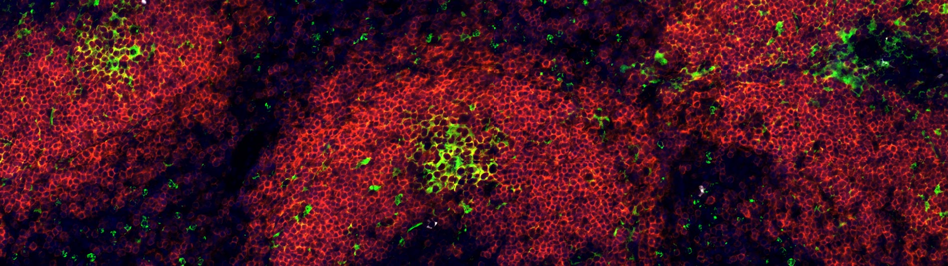 KO-12-Igg-B220-PNA_p01(c1+c2+c3+c4)