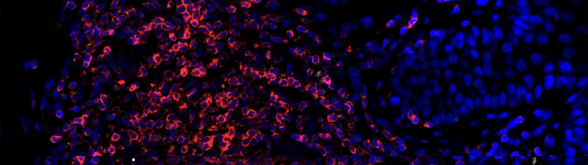 TIL136-CD3r-DCSTAMP-v-RANKLw_p1(c1+c2+c3+c4)