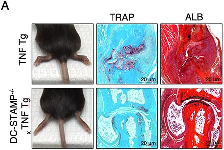 TNF Tg mice show visibly swollen joints