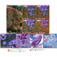 Four Channel Imaging with Parallel Multiphoton Microscopy