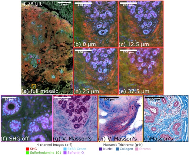 Four Channel Imaging with Parallel Multiphoton Microscopy