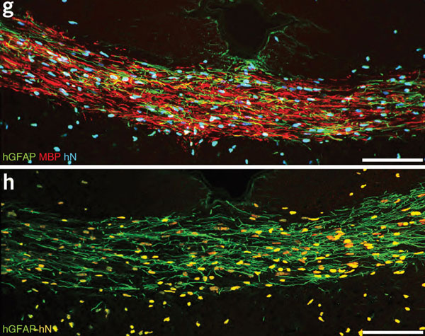 Image of oligio progenitor cells