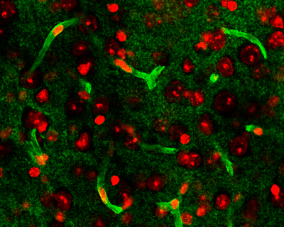 Microscopic slide of glymphatics