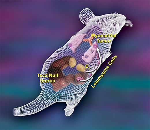 Tsc2 null LAM smooth muscle cell tumors in the lungs may be metastatic from Tsc2 null smooth muscle cells tumors in the uterus