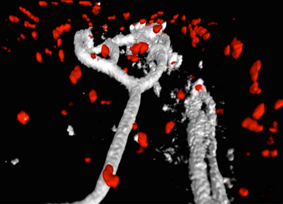 Image of neutrophil response to T cells