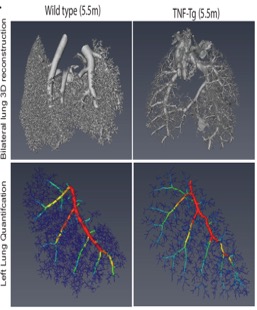 3D bilateral lung reconstruction in wild type vs TNF-tg mice